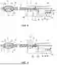 Fig. 05 - A THROMBECTOMY DEVICE