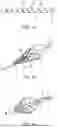 Fig. 08 - A THROMBECTOMY DEVICE