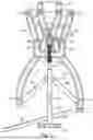 Fig. 02 - Adjustable angle orthopedic distractor, compressor, and distractor-compressor