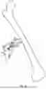 Fig. 06 - Adjustable angle orthopedic distractor, compressor, and distractor-compressor