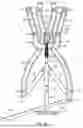 Fig. 07 - Adjustable angle orthopedic distractor, compressor, and distractor-compressor