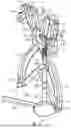 Fig. 08 - Adjustable angle orthopedic distractor, compressor, and distractor-compressor