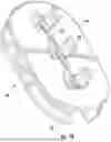 Fig. 10 - SURGICAL SENSOR ANCHOR SYSTEM