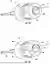 Fig. 23 - SURGICAL SENSOR ANCHOR SYSTEM
