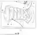 Fig. 28 - SURGICAL SENSOR ANCHOR SYSTEM