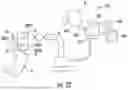 Fig. 30 - SURGICAL SENSOR ANCHOR SYSTEM