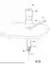 Fig. 33 - SURGICAL SENSOR ANCHOR SYSTEM