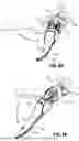 Fig. 07 - ROBOTIC SURGICAL SYSTEM WITH INSTRUMENT BAILOUT AND LOCKOUT FEATURES