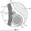 Fig. 08 - BRAIDED ARTICULATION ASSEMBLY FOR ELONGATE MEMBER