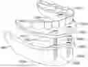 Fig. 01 - DENTAL ATTACHMENT ASSEMBLIES,  ANGLED IMPLANT ASSEMBLIES, AND METHODS OF USE