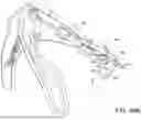 Fig. 71 - PROSTHETIC SUTURING DEVICE AND METHODS THEREOF