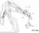 Fig. 79 - PROSTHETIC SUTURING DEVICE AND METHODS THEREOF