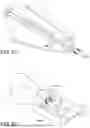 Fig. 85 - PROSTHETIC SUTURING DEVICE AND METHODS THEREOF