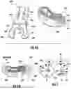 Fig. 07 - SURGICAL IMPLANT POSITION DETECTION
