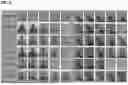 Fig. 07 - COMPOSITION FOR TREATING OF FACIAL DYSMORPHISM IN MUCOPOLYSACCHARIDOSIS