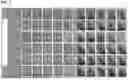 Fig. 08 - COMPOSITION FOR TREATING OF FACIAL DYSMORPHISM IN MUCOPOLYSACCHARIDOSIS