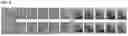 Fig. 09 - COMPOSITION FOR TREATING OF FACIAL DYSMORPHISM IN MUCOPOLYSACCHARIDOSIS