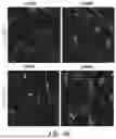 Fig. 07 - SYSTEMS AND METHODS FOR REGULATING ABERRANT GENE EXPRESSIONS
