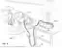 Fig. 02 - RESPIRATORY PRESSURE THERAPY SYSTEM