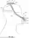 Fig. 09 - RESPIRATORY PRESSURE THERAPY SYSTEM