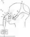 Fig. 01 - RESPIRATORY MASK HAVING A MAGNETICALLY SUPPORTED CUSHION