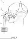 Fig. 02 - RESPIRATORY MASK HAVING A MAGNETICALLY SUPPORTED CUSHION