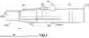 Fig. 02 - Catheter Adapter with Integrated Adhesive Dispenser