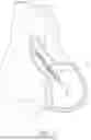Fig. 04 - SHEATH ASSEMBLY FOR CATHETER PUMP