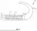 Fig. 02 - INTRAVASCULAR DEVICE WITH A MATCHED DIAMETER CORE WIRE JOINT