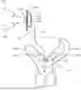 Fig. 01 - APPARATUS FOR TEMPORARY MALE CONTRACEPTION