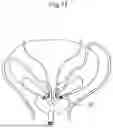 Fig. 04 - APPARATUS FOR TEMPORARY MALE CONTRACEPTION