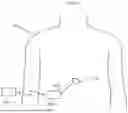 Fig. 05 - APPARATUS FOR TEMPORARY MALE CONTRACEPTION