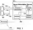 Fig. 02 - SYSTEMS AND METHODS FOR OPTIMIZING NERVE STIMULATION THERAPY