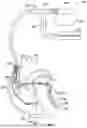 Fig. 02 - METHOD AND SYSTEM FOR IMPLANTING A SEPTAL WALL ELECTRODE