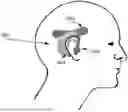 Fig. 01 - EARPIECE ASSEMBLY TO INTERACT WITH IMPLANTABLE NEURAL STIMULATORS