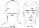 Fig. 09 - EARPIECE ASSEMBLY TO INTERACT WITH IMPLANTABLE NEURAL STIMULATORS