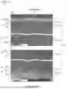 Fig. 02 - HOLLOW FIBER MEMBRANE AND MANUFACTURING METHOD THEREFOR