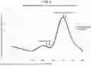 Fig. 07 - METHODS FOR TREATING NEPHROTIC SYNDROME