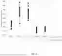 Fig. 04 - STRUCTURED DENSE FLUOROPOLYMER FILMS AND METHODS OF MAKING SAME