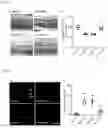 Fig. 08 - COMPOSITION FOR TREATING DIABETIC RETINOPATHY CONTAINING scAAV2-shmTOR-SD (CRG-01)