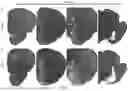 Fig. 28 - DOPAMINERGIC PRECURSOR CELLS AND METHODS OF USE