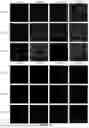 Fig. 35 - DOPAMINERGIC PRECURSOR CELLS AND METHODS OF USE