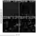 Fig. 41 - DOPAMINERGIC PRECURSOR CELLS AND METHODS OF USE