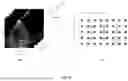 Fig. 04 - SUPER RESOLUTION FOR ELECTRONIC 4D (E4D) CARDIOVASCULAR ULTRASOUND (CVUS) PROBES