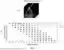 Fig. 05 - SUPER RESOLUTION FOR ELECTRONIC 4D (E4D) CARDIOVASCULAR ULTRASOUND (CVUS) PROBES