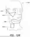 Fig. 17 - SYSTEM AND METHOD FOR USING GESTURES AND EXPRESSIONS FOR CONTROLLING SPEECH APPLICATIONS
