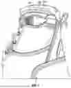 Fig. 03 - Locking Boot Fastening Device and Method