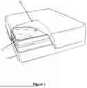 Fig. 02 - FLEXIBLE MATERIAL TIGHTENER WITH RESILIENT COUPLER