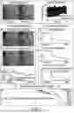 Fig. 02 - MEANS AND METHODS FOR SELECTING PATIENTS FOR IMPROVED PERCUTANEOUS CORONARY INTERVENTIONS