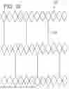 Fig. 06 - EXPANDABLE SHEATH FOR INTRODUCING AN ENDOVASCULAR DELIVERY DEVICE INTO A BODY